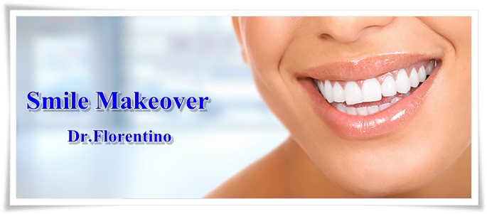 Smile Makeover Dominican Republic