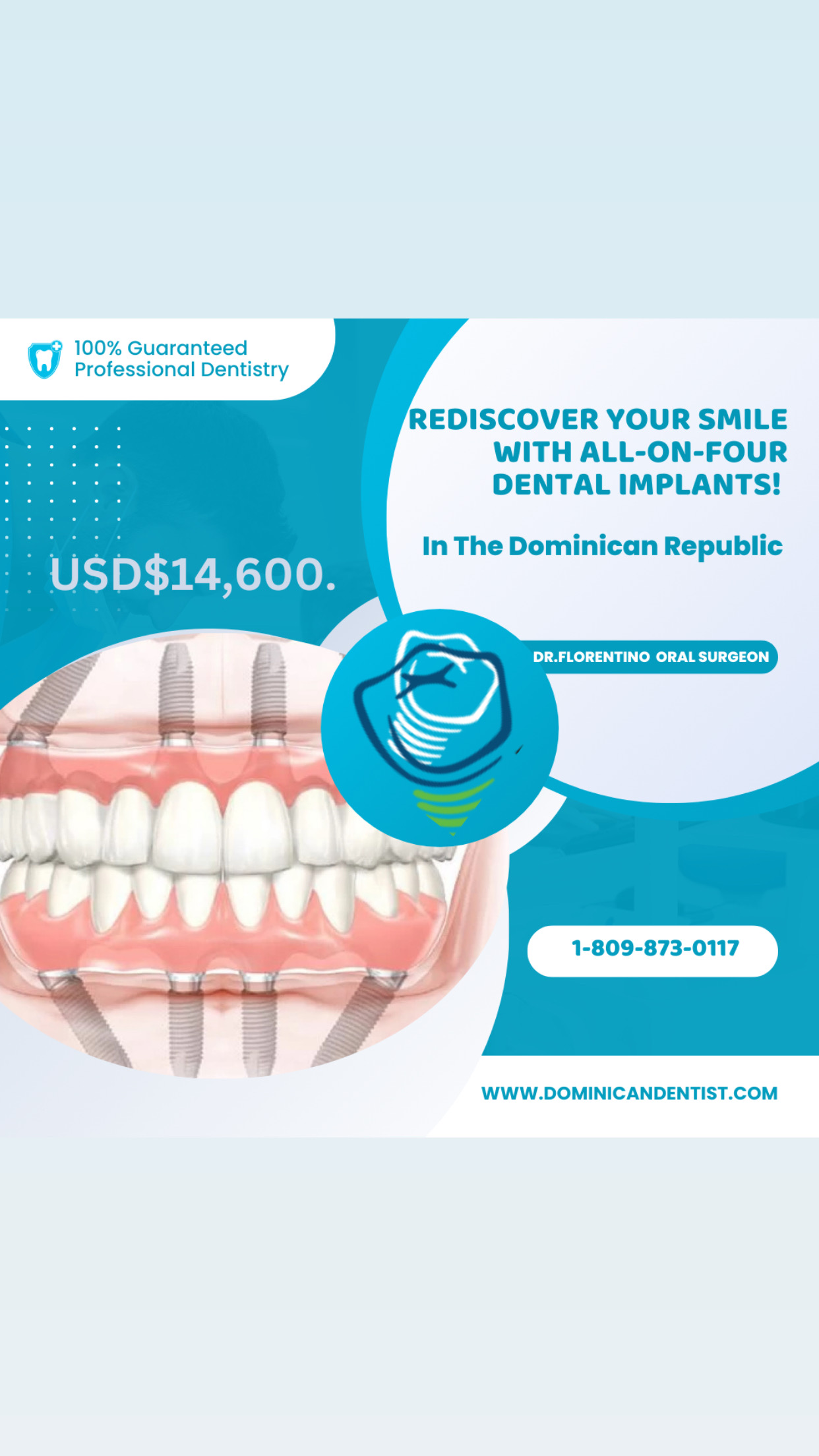 All On Four Dental Implants Dominican Republic