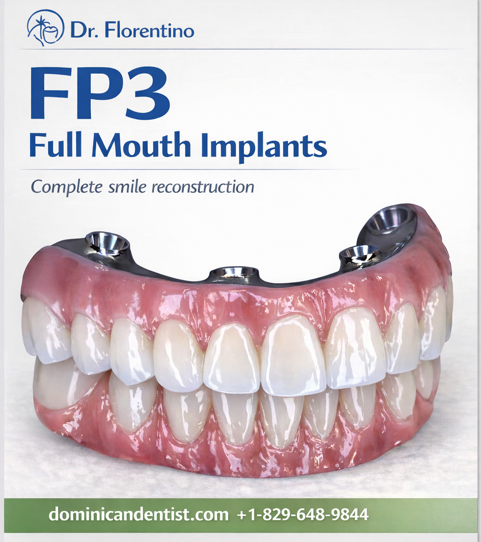 FP3 Full Mouth Dental Implants