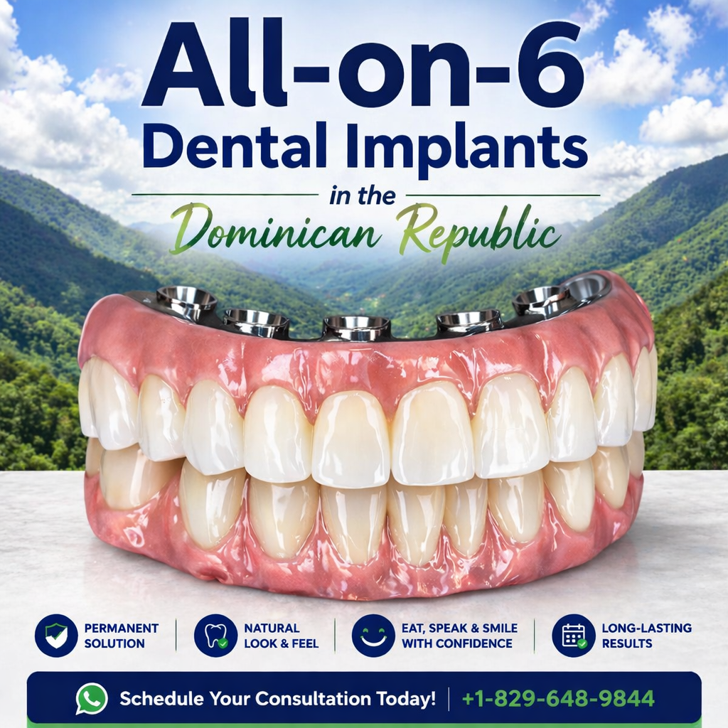All on 6 Dental Implants in the Dominican Republic by Dr.Florentino