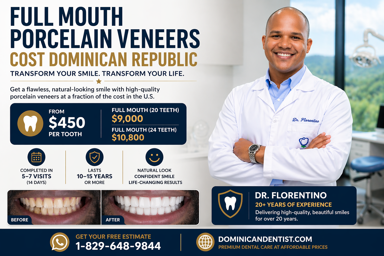 Full Mouth Porcelain Veneers Cost in Dominican Republic